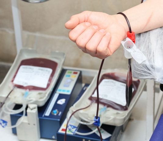 Close-up of blood donation process showing a donor's arm and blood bags in a clinic.