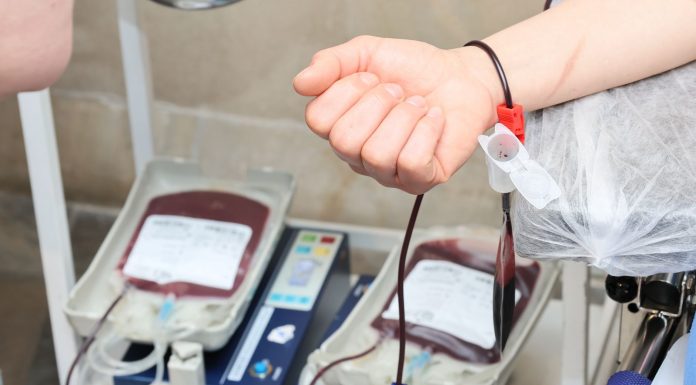 Jersey City Medical Center Pleads for Blood Donations Amid Critical Shortage Close-up of blood donation process showing a donor's arm and blood bags in a clinic.